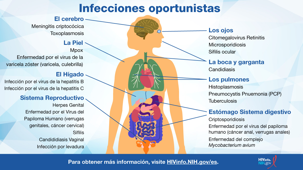 Nombres de varias infecciones oportunistas.