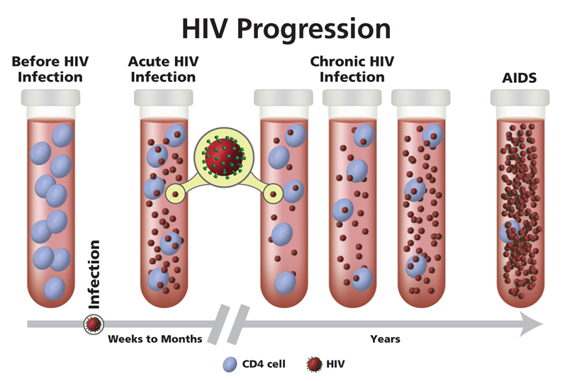 The Stages Of Hiv Infection