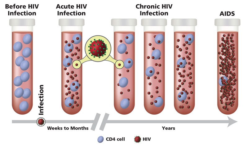 Series of test tubes containing varying amounts of HIV particles and CD4 cells to depict the course of HIV infection.