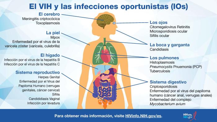  Vea esta infográfica para ver ejemplos de OIs y las partes del cuerpo que pueden afectar.