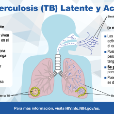 Aprende la diferencia entre los dos estados de infección por TB, tuberculosis latente y activa. Aprende la diferencia entre los dos estados de infección por TB, tuberculosis latente y activa.