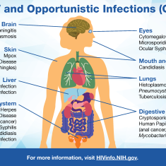 View this infographic for examples of OIs and the body parts they can affect.