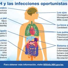 Vea esta infográfica para ver ejemplos de OIs y las partes del cuerpo que pueden afectar. Vea esta infográfica para ver ejemplos de OIs y las partes del cuerpo que pueden afectar.