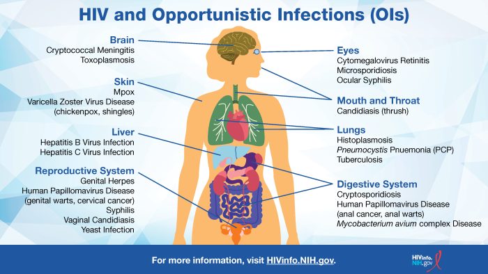 View this infographic for examples of OIs and the body parts they can affect.